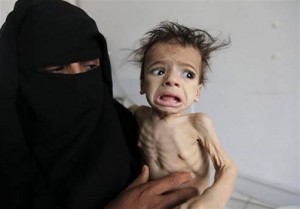 هشدار یونیسف درباره تمام شدن سوخت و واکسن در یمن 