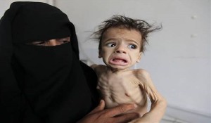 فائو هشدار داد : قحطی در یمن و ۳ کشور آفریقایی به ایجاد فاجعه انسانی نزدیک می‌شود 